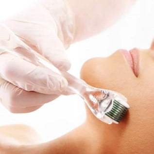 Microneedling (Derma Rolling) Course